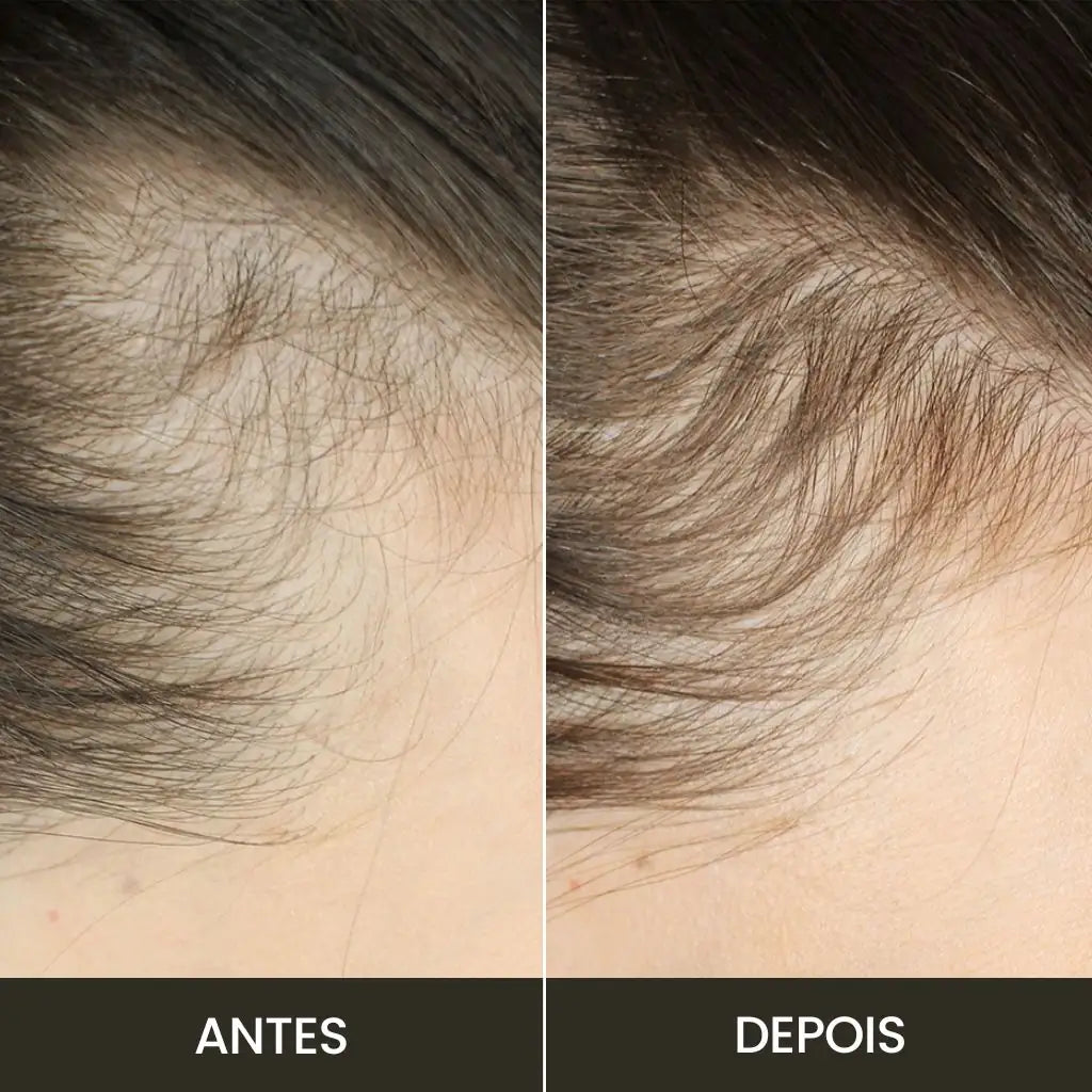 Escova de Terapia Capilar Revivá